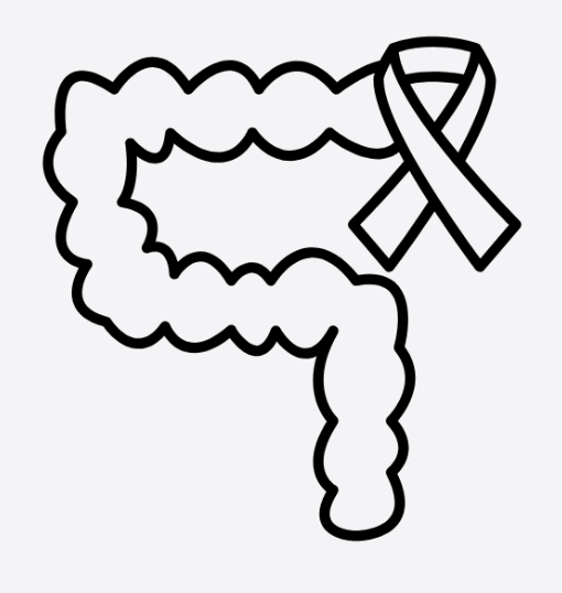 Colorectal cancer